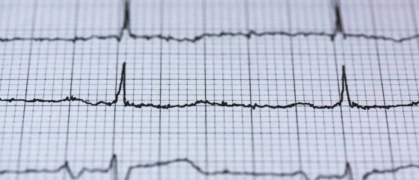 Interview with Javier González, Materials Engineer and founder of The Open Ventilator